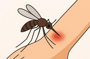 mosquito bite